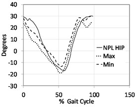 Kinematics results in sagittal plane indicating hip, knee & ankle joints for non-prosthetic leg NPL (solid line) versus the prosthetic leg (dashed line) where the participants were using a Jaipur knee joint.