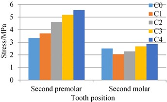Stress of the periodontal ligament of the natural teeth adjacent to the implant