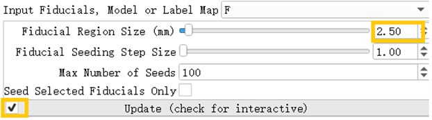 Tracketography seeding parameter interface, Fiducial Region Size controls the size  of the fiber bundle, and the check mark before ‘Update’ allows the seed  (marking point) to move freely as the seed (marking point) moves