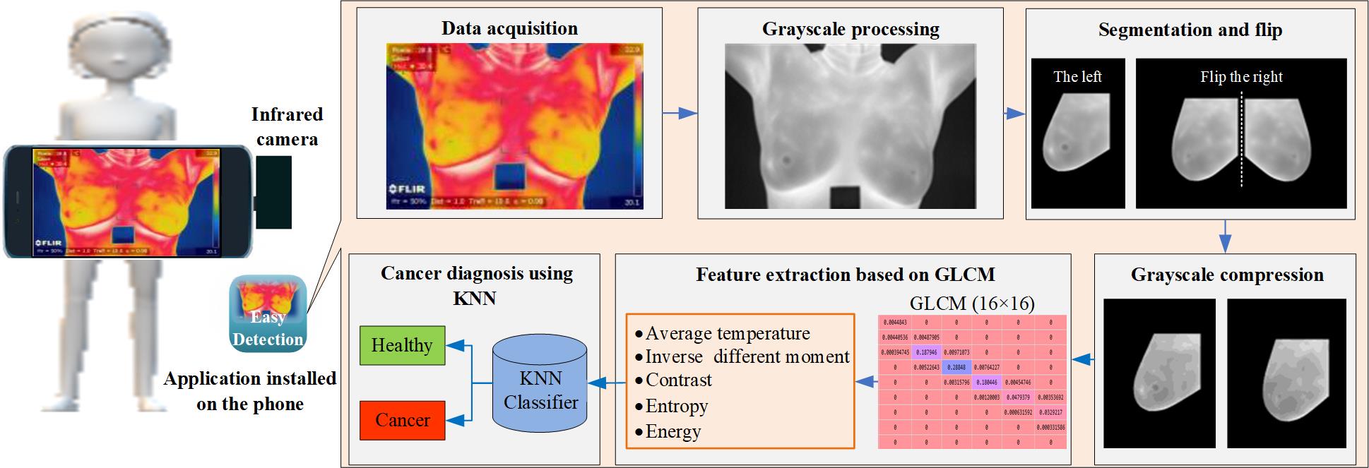 A portable breast cancer detection system based on smartphone with infrared camera