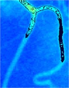 Iterations of segmentation of blood vessel image
