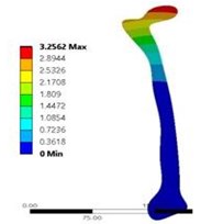 a) Total deformation in coxa norma, and b) vonmises stress distribution coxa norma  in 2D model static analysis