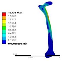 a) Total deformation in coxa norma, and b) vonmises stress distribution coxa norma  in 2D model static analysis