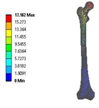 Total deformation in: a) coxa valga, b) coxa norma, c) coxa vara in 3D model static analysis