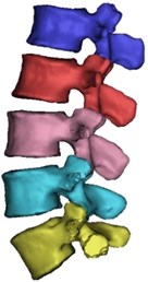 a) CT scan in DICOM format, b) Segmentation in MIMICS 21.0, c) Accurate surfaces in 3-Matic