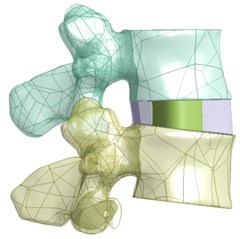 a) L3-L4 vertebrae with IVD b) Intervertebral disc c) Meshed model of lumbar region