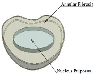 a) L3-L4 vertebrae with IVD b) Intervertebral disc c) Meshed model of lumbar region