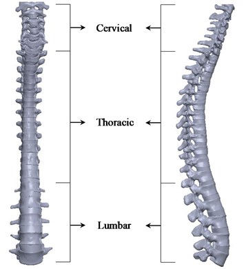 Front view (left), lateral view (right) of the CTL spine with intervertebral discs