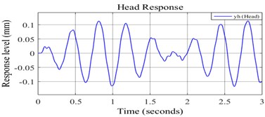 a) Undamped response of pilot’s head, b) damped response of pilot’s head