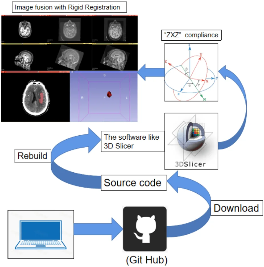 Secondary development process of slicer based on workflow of intracranial hematoma