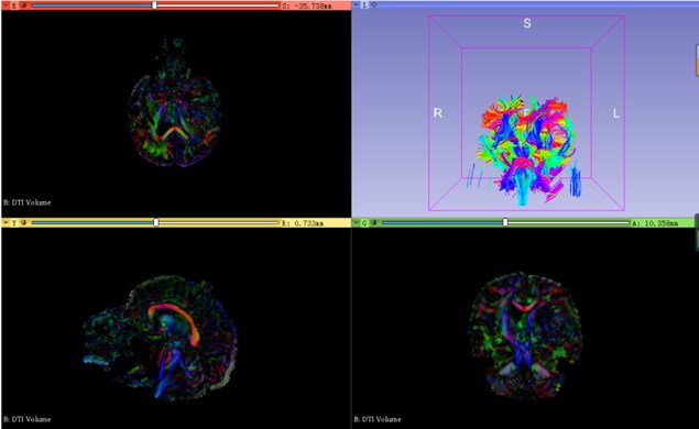 Neural bundle modeling in brain