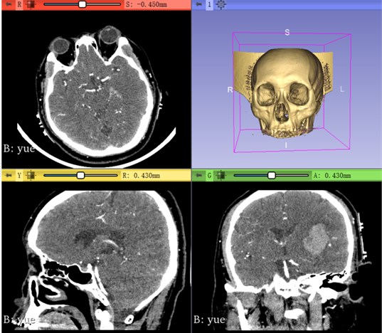 Skull rendering