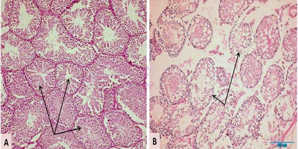 Two photomicrographs showing general testis histology of a control mouse (A)