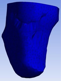 Von-Mises stress of the stump-socket interface