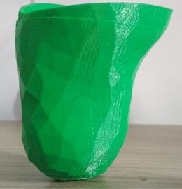 Final socket prepared by using 3D printing