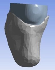 Stump-socket CAD model