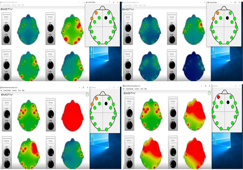 EEG results for various pathologies