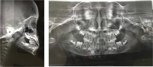 Extra- and intraoral photographs (upper and lower section, respectively);  Teleradiograph and panoramic radiography (second line)