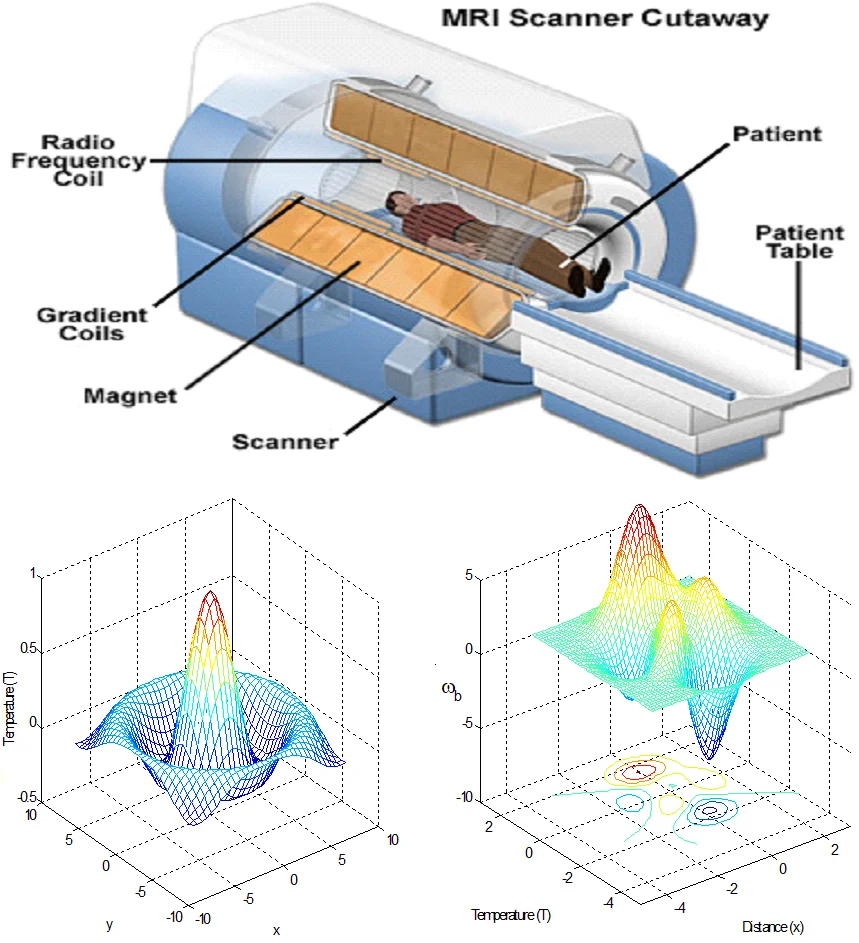 Heat transfer and the influence of electromagnetic field and thermal time during temperature distribution in human tissue