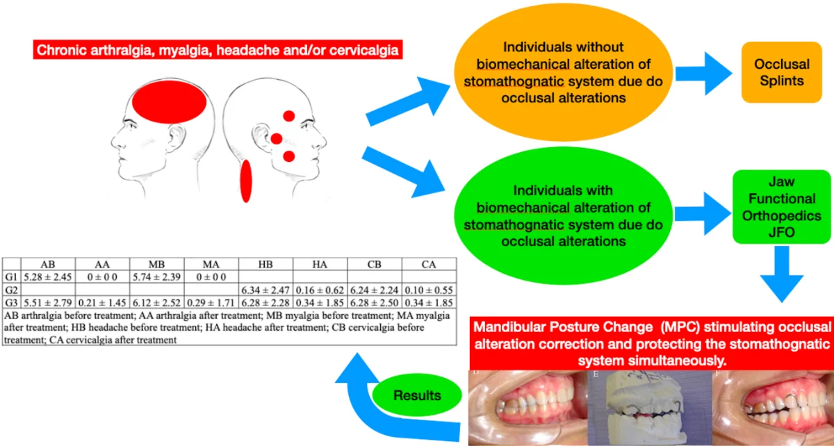 Treatment of temporomandibular dysfunction with jaw functional orthopedics: a retrospective study
