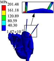 Finite element analysis results of AB1 group
