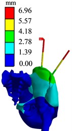 Finite element analysis results of AB1 group