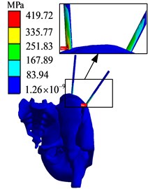 Finite element analysis results of AB2 group