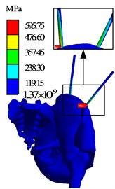 Finite element analysis results of AB3 group