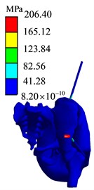 Finite element analysis results of AC1 group