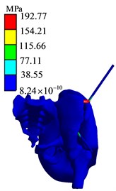 Finite element analysis results of BC1 group