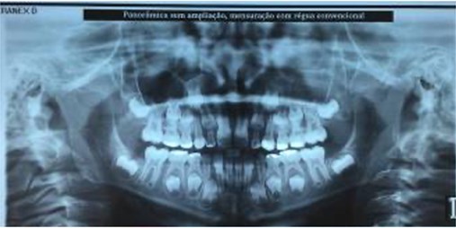 a) Extraoral photographs (T2), b) intraoral photographs (T2),  and c) orthopantomogram (T2); T2 refers to the post-treatment stage