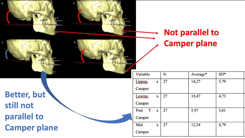 Occlusal plane parallel to camper plane: reality or fallacy? A tomographic study on human Sambaqui skeletal remains