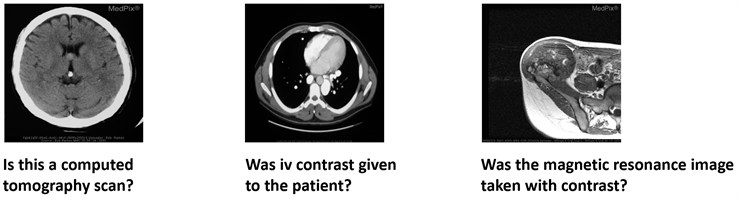 Examples of image-question pairs used in the work [1]