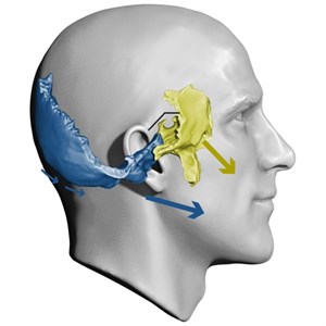 Influence of base cranium bones on the face and on occlusion