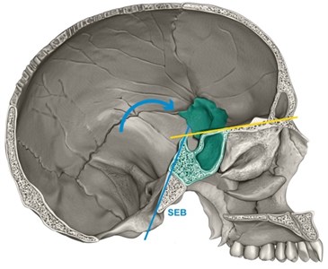Base cranium flexion