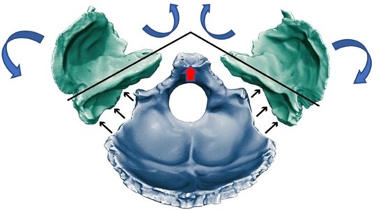 Anterior rotation of the occipital produces greater transverse development  of the squamous part, favoring frontalisation of the temporal petrous pyramids