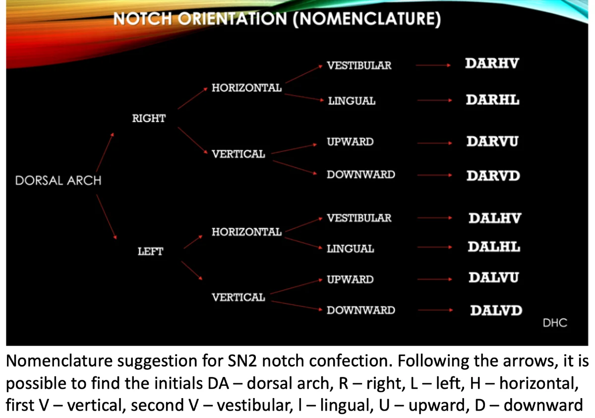 Simões Network 2 (SN2): A special model for special needing