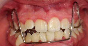 The patient's dental files and occlusal records