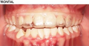 The patient's dental files and occlusal records
