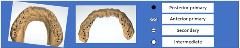 Occlusal support contacts (O.S.C.)