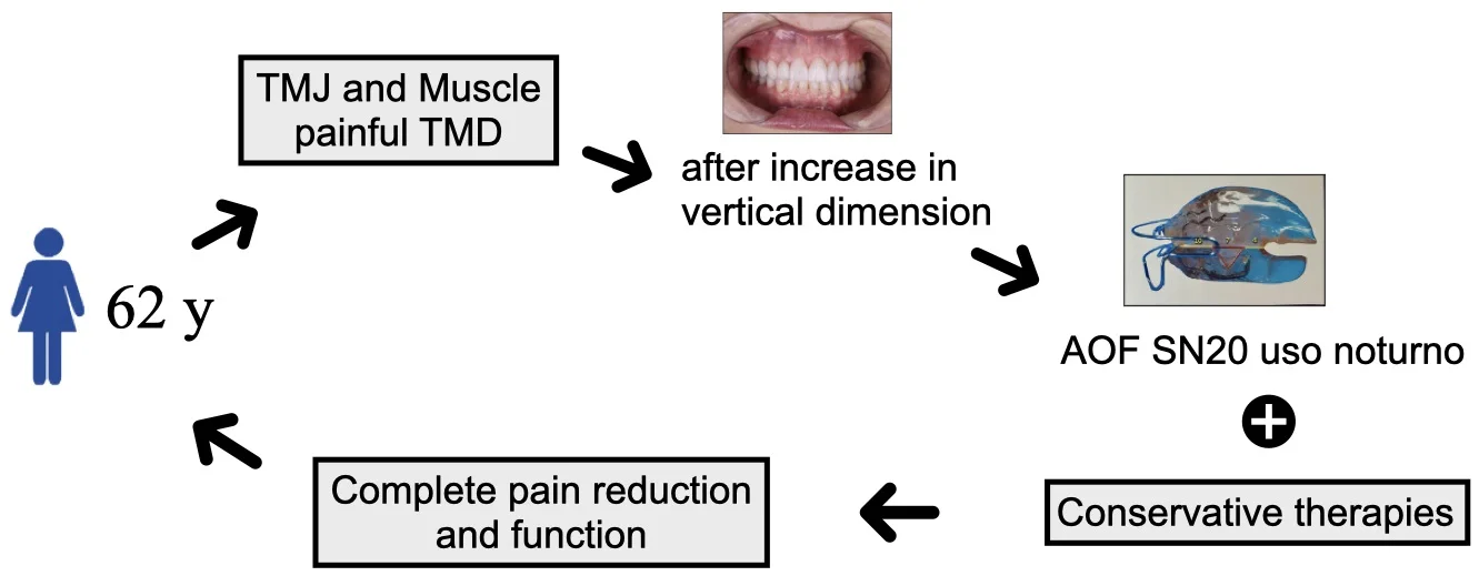 Functional orthopedic device type Sn20 – a therapeutic resource in the control of chronic temporomandibular dysfunction – case report