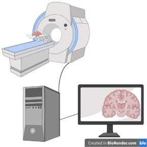 Computerized Tomography (CT) schematic image (created in BioRender.com)