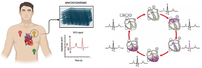 The image of the AMWCNT/GP/PDMS composite structure and the waves  of scientifically accepted ECG signals are shown in the graph [18]