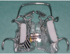 SN7 brace: a) SN7 in occlusion; b) superior occlusal view of SN7; c) inferior occlusal view of SN7