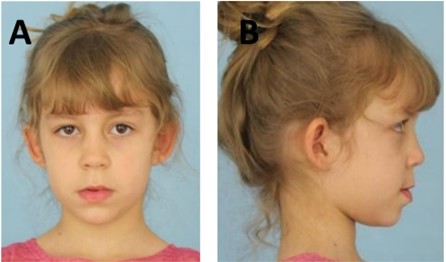 a) Initial extra-oral photographs of the front and b) right side