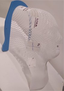 Photograph of a radiotherapy mask manufactured by additive manufacturing. This mask is used to immobilize the patient during radiotherapy sessions in the head and neck region.  Photo credits: Author RFN, 2023