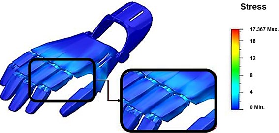 Static load analysis applied to prosthesis