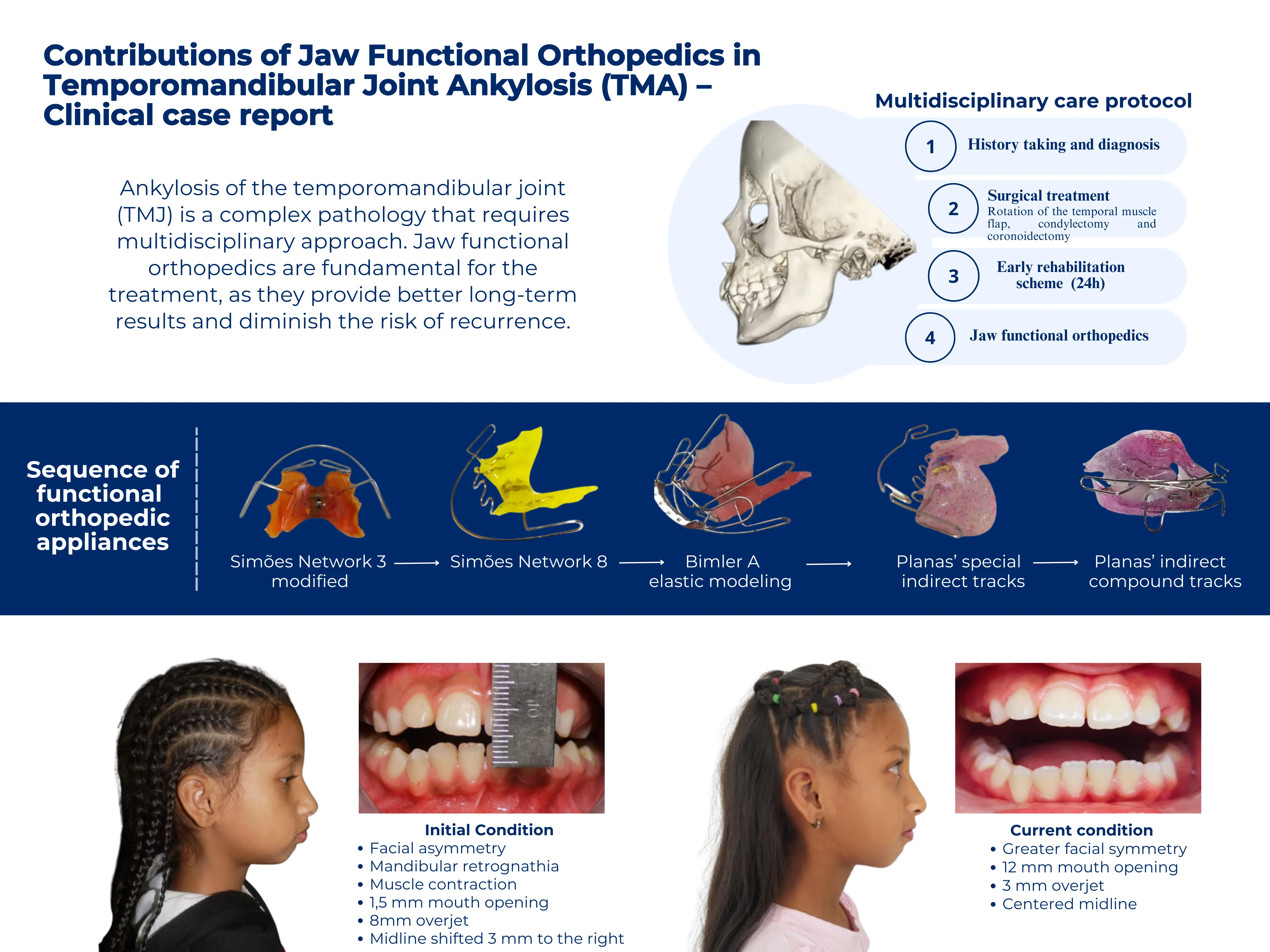 Contributions of jaw functional orthopedics in temporomandibular joint ankylosis (TMA) – clinical case report