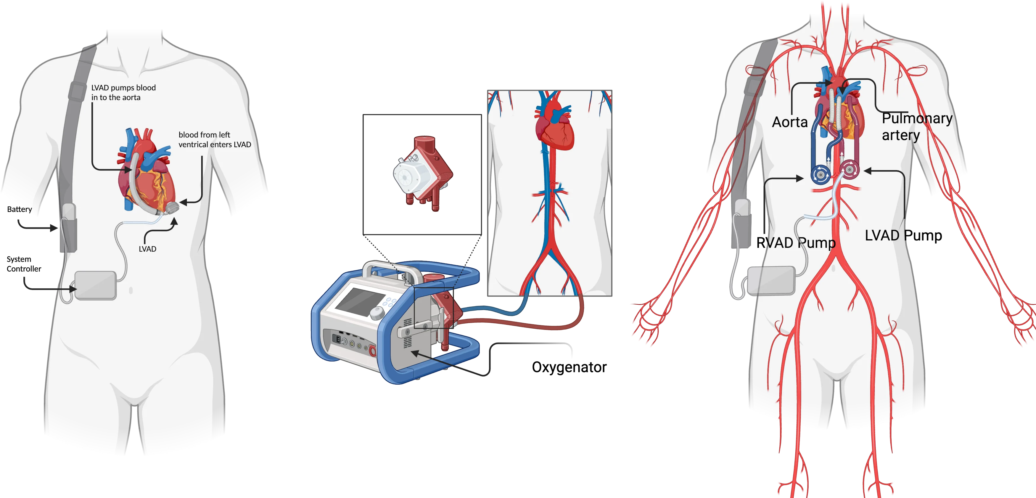 Unveiling the future of cardiac care: advances in mechanical circulatory support