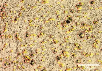 Surface morphology of titanium after cavitation water jet treatment